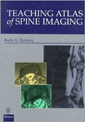 TEACHING ATLAS OF SPINE IMAGING