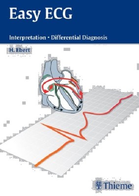 EASY ECG