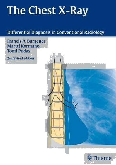 THE CHEST X-RAY