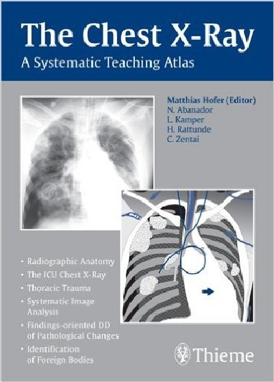 THE CHEST X-RAY