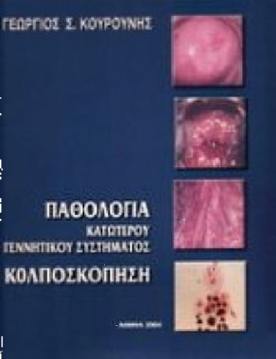 ΠΑΘΟΛΟΓΙΑ ΚΑΤΩΤΕΡΟΥ ΓΕΝΝΗΤΙΚΟΥ ΣΥΣΤΗΜΑΤΟΣ ΚΟΛΠΟΣΚΟΠΗΣΗ