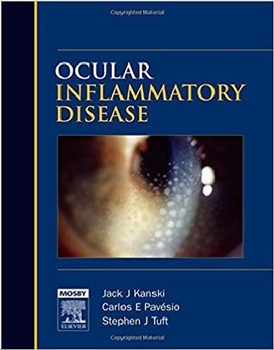 OCULAR INFLAMMATORY DISEASE