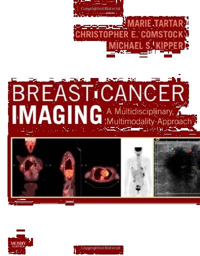 BREAST CANCER IMAGING