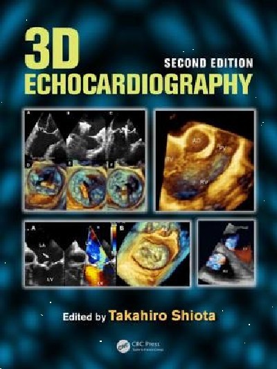 3D ECHOCARDIOGRAPHY