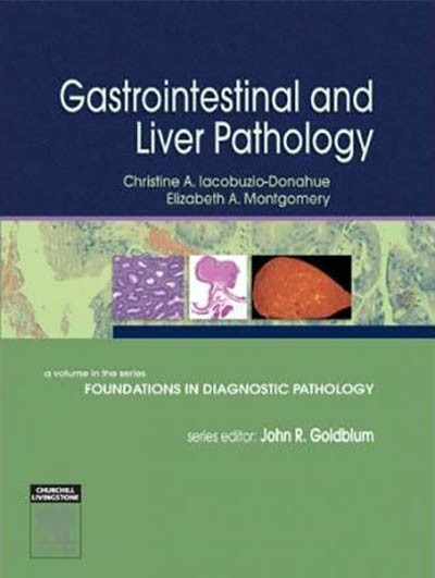 GASTROINTESTINAL AND LIVER PATHOLOGY