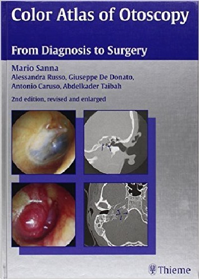 COLOR ATLAS OF OTOSCOPY