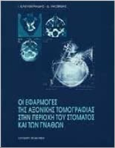 ΟΙ ΕΦΑΡΜΟΓΕΣ ΤΗΣ ΑΞΟΝΙΚΗΣ ΤΟΜΟΓΡΑΦΙΑΣ ΣΤΗΝ ΠΕΡΙΟΧΗ ΤΟΥ ΣΤΟΜΑΤΟΣ ΚΑΙ ΤΩΝ ΓΝΑΘΩΝ